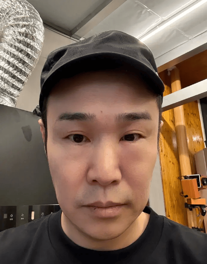 小沈阳晒照称自己眼睛肿了：大家看直播别乐出来就行封面图
